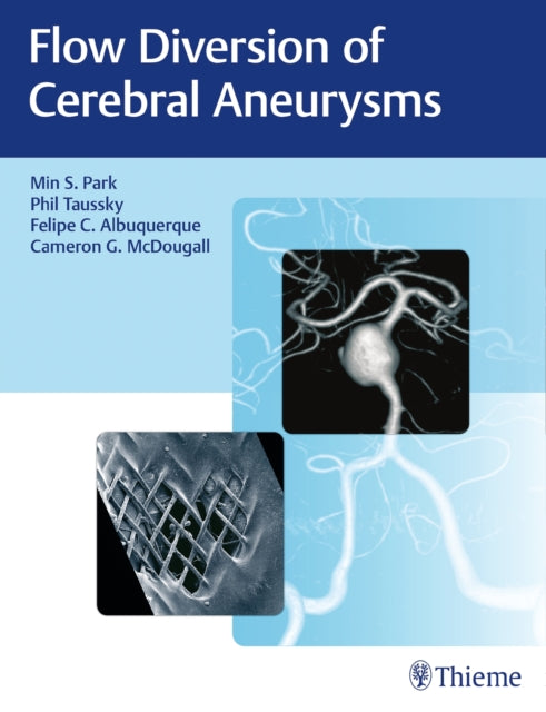Book cover of: Flow Diversion of Cerebral Aneurysms. By: Min S. Park