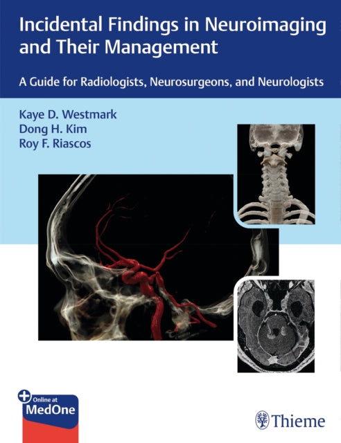Book cover of: Incidental Findings in Neuroimaging and Their Management. By: Kaye Westmark