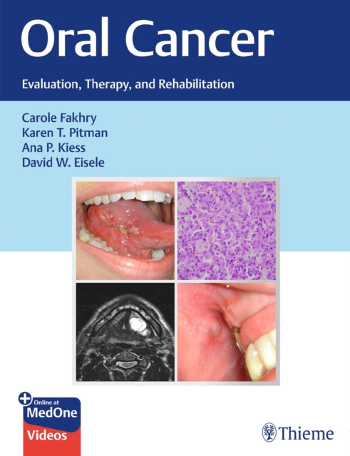 Book cover of: Oral Cancer. By: Carole Fakhry