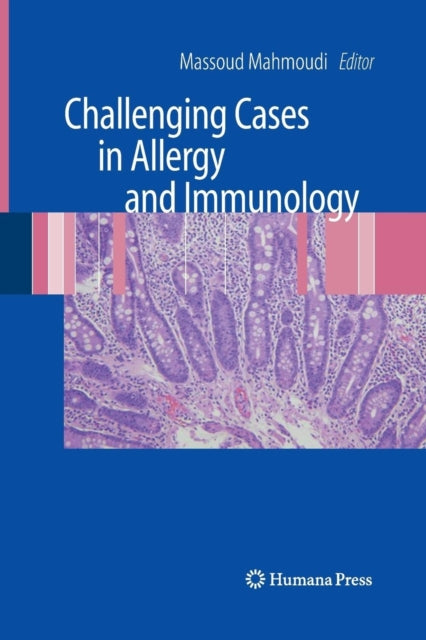 Book cover of: Challenging Cases in Allergy and Immunology. By: Massoud Mahmoudi