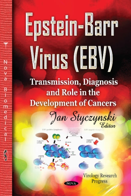 Book cover of: Epstein-Barr Virus (EBV)