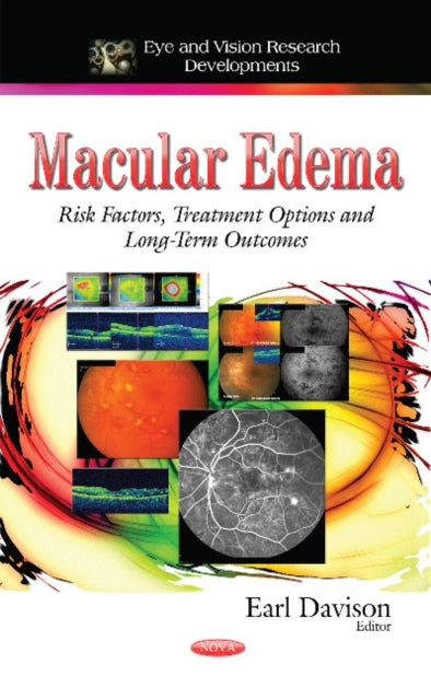 Book cover of: Macular Edema. By: Earl Davison