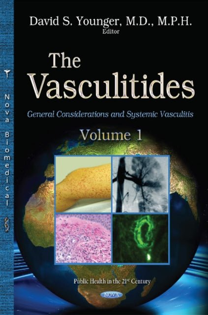 Book cover of: Vasculitides. By: David Steven Younger
