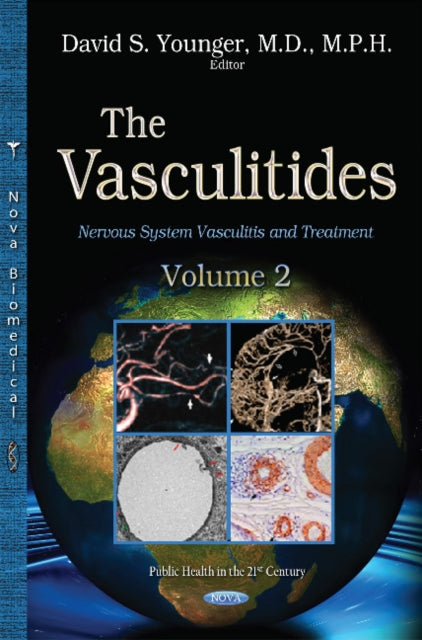 Book cover of: Vasculitidies. By: David Steven Younger