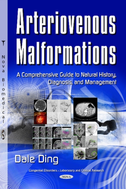 Book cover of: Arteriovenous Malformations. By: Dale Ding