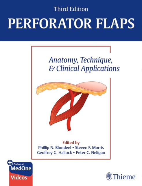 Book cover of: Perforator Flaps. By: Phillip Blondeel