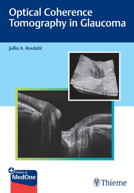 Book cover of: Optical Coherence Tomography in Glaucoma. By: Jullia Rosdahl