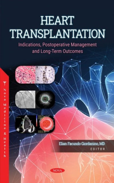 Book cover of: Heart Transplantation. By: Elian Facundo Giordanino