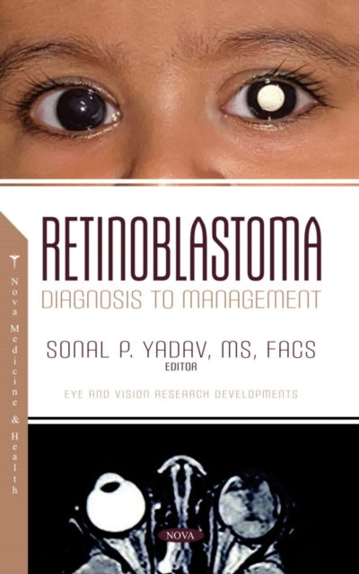 Book cover of: Retinoblastoma: Diagnosis to Management. By: Sonal P. Yadav