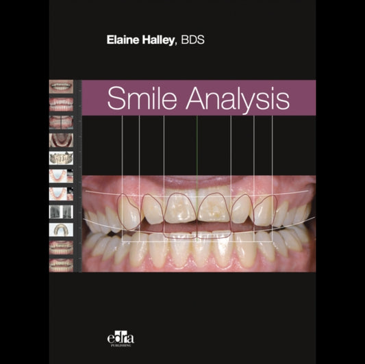 Book cover of: Smile Analysis. By: Elaine Halley