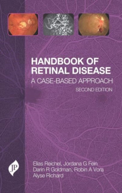 Book cover of: Handbook of Retinal Disease. By: Elias Reichel