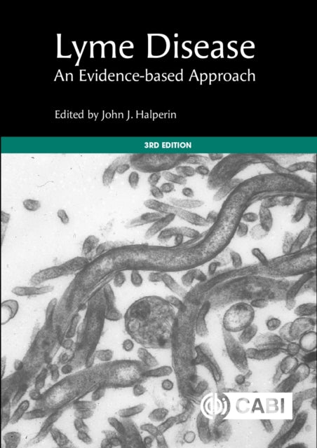Book cover of: Lyme Disease