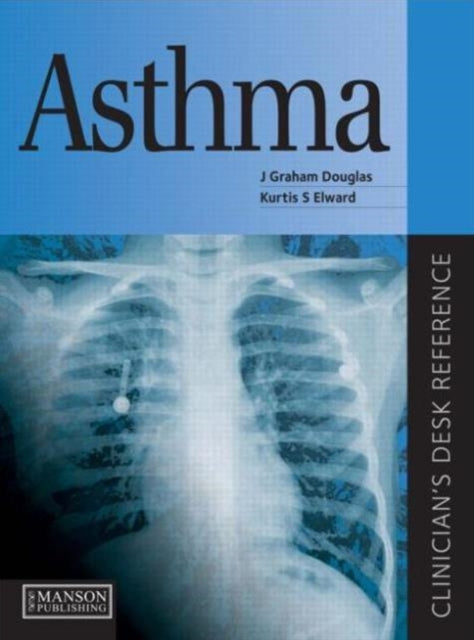Book cover of: Asthma