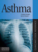 Book cover of: Asthma