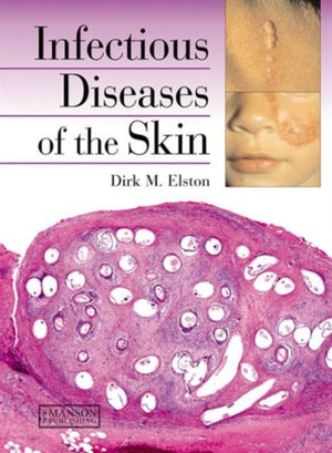 Infectious Diseases of the Skin