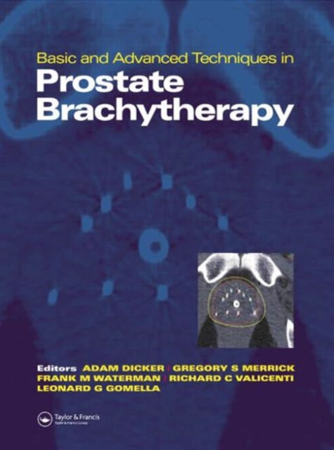 Book cover of: Basic and Advanced Techniques in Prostate Brachytherapy