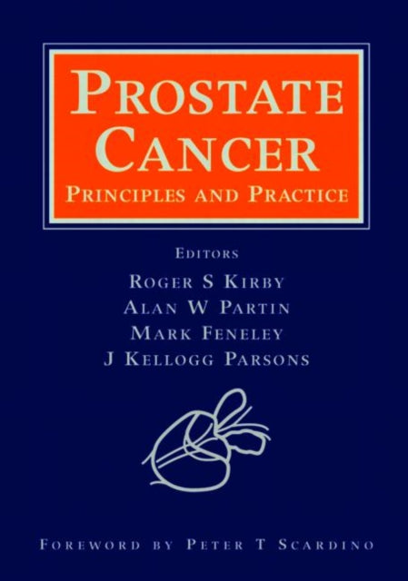 Book cover of: Prostate Cancer