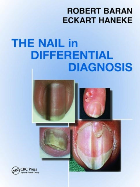 Book cover of: Nail in Differential Diagnosis. By: Robert Baran