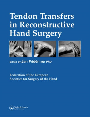 Tendon Transfers in Reconstructive Hand Surgery