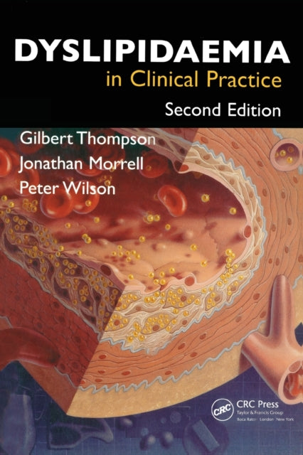 Book cover of: Dyslipidaemia in Clinical Practice. By: Gilbert Thompson