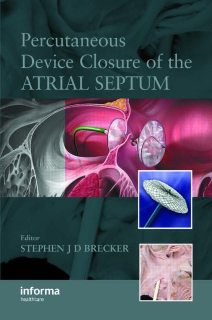 Book cover of: Percutaneous Device Closure of the Atrial Septum. By: Stephen J.D. Brecker