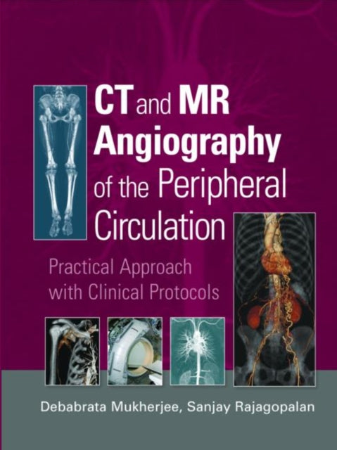 Book cover of: CT and MR Angiography of the Peripheral Circulation