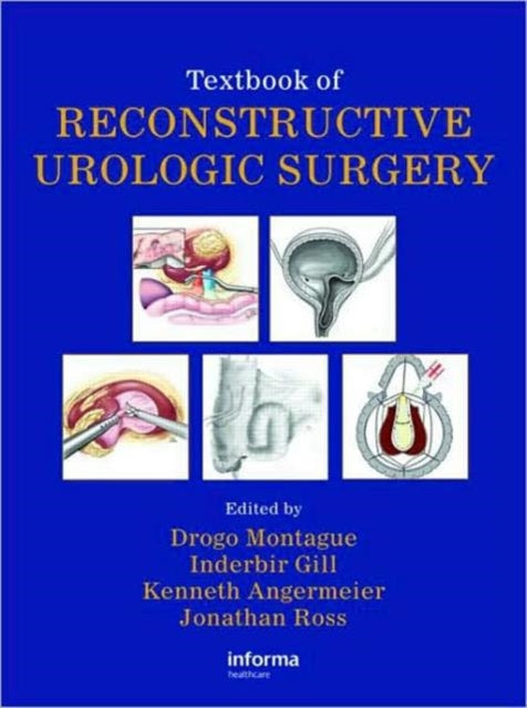 Book cover of: Textbook of Reconstructive Urologic Surgery