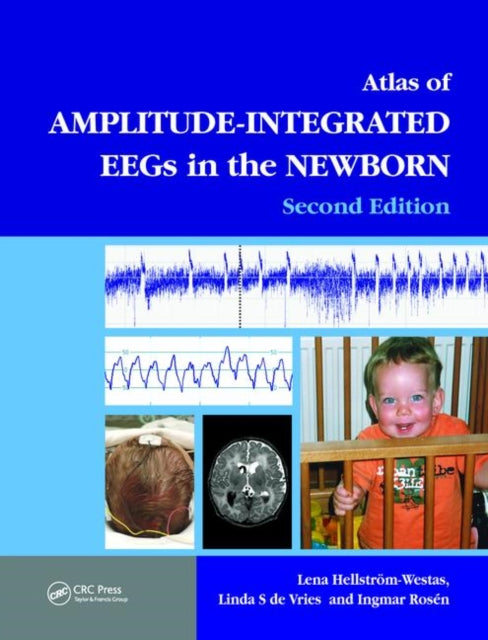 Vastsündinu amplituudiga integreeritud EEG-de atlas