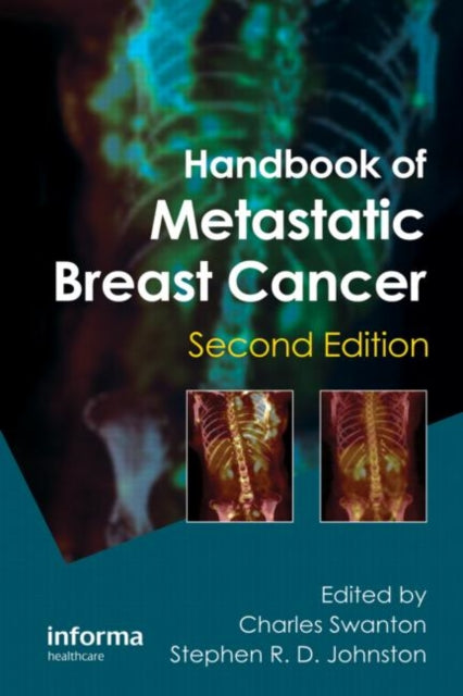 Book cover of: Handbook of Metastatic Breast Cancer. By: Charles Swanton