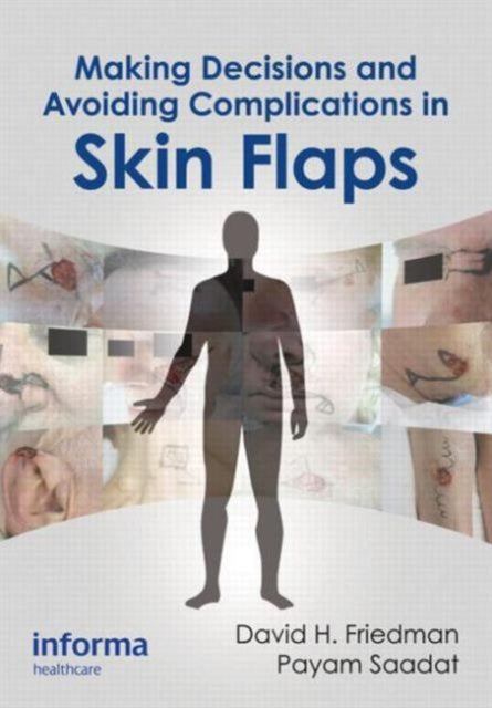 Book cover of: Making Decisions and Avoiding Complications in Skin Flaps. By: Friedman, David H.