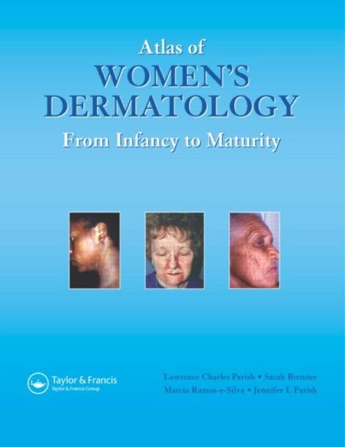 Book cover of: Atlas of Women's Dermatology. By: Lawrence C. Parish