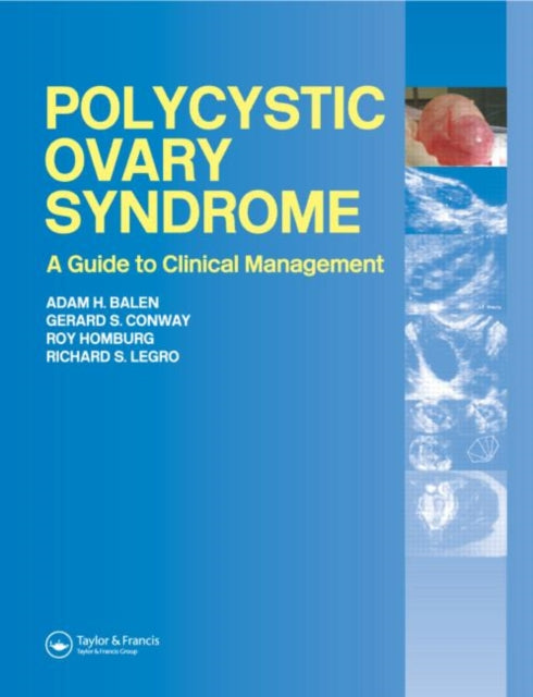 Book cover of: Polycystic Ovary Syndrome. By: Adam Balen