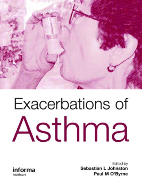 Book cover of: Exacerbations of Asthma