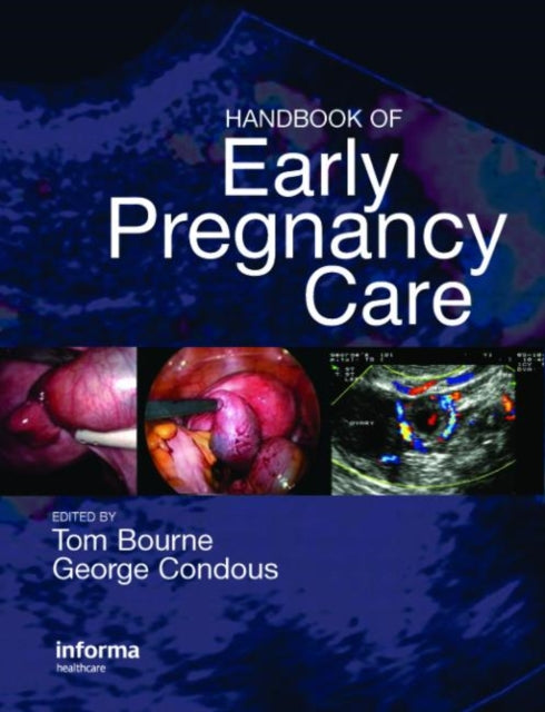 Book cover of: Handbook of Early Pregnancy Care