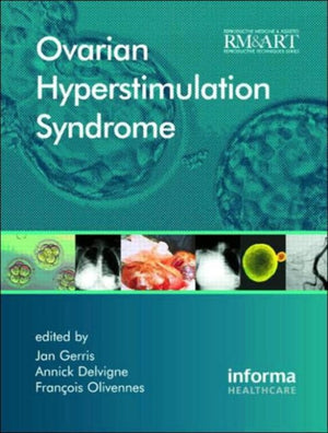 Ovarian Hyperstimulation Syndrome