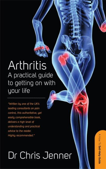 Artriit