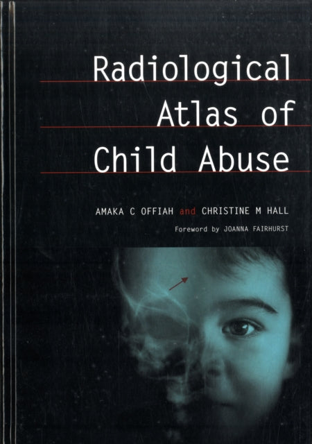 Book cover of: Radiological Atlas of Child Abuse. By: Amaka Offiah