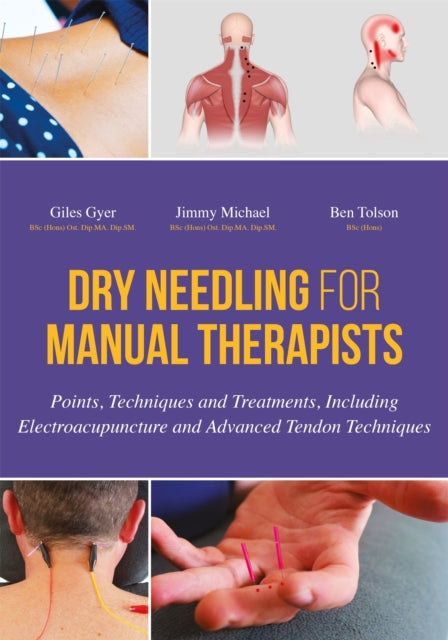 Book cover of: Dry Needling for Manual Therapists. By: Giles Gyer