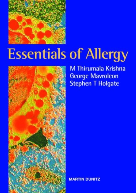 Book cover of: Essentials of Allergy