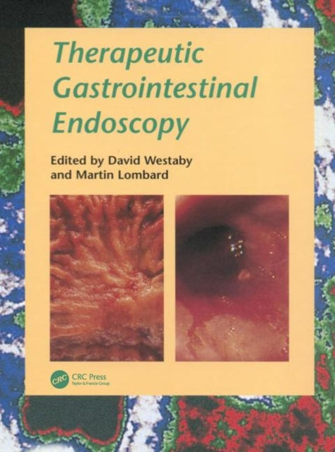 Book cover of: Therapeutic Gastrointestinal Endoscopy