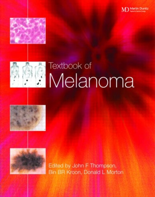 Book cover of: Textbook of Melanoma