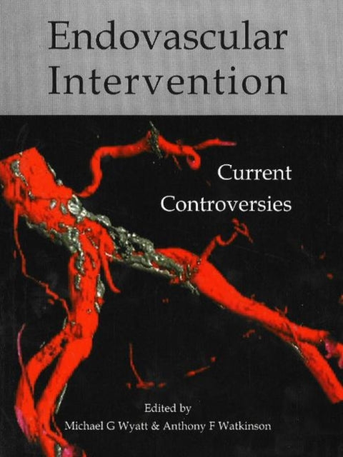 Book cover of: Endovascular intervention. By: Watkinson Anthony