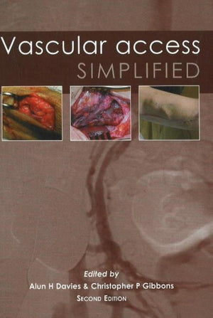Vascular Access Simplified; second edition