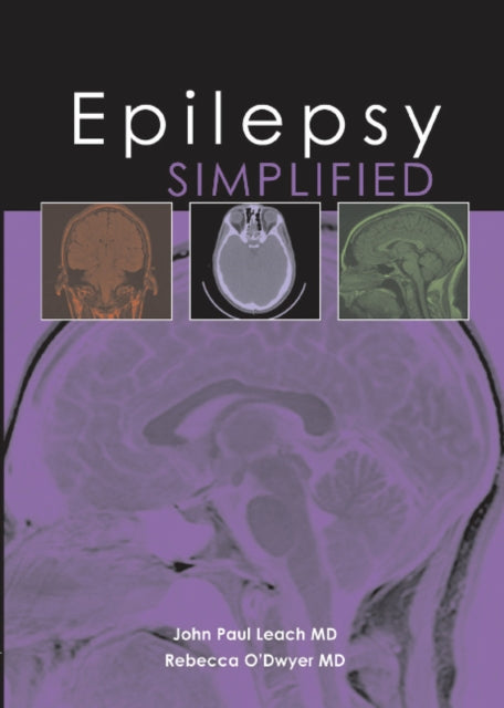 Book cover of: Epilepsy Simplified. By: John Paul Leach