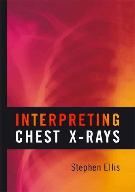 Book cover of: Interpreting Chest X-Rays. By: Stephen Ellis