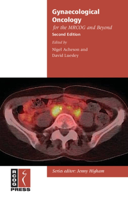 Book cover of: Gynaecological Oncology for the MRCOG and Beyond