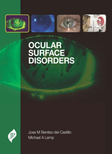 Book cover of: Ocular Surface Disorders. By: Jose M. Benitez-del-Castillo