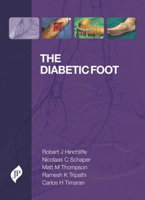 Diabetic Foot