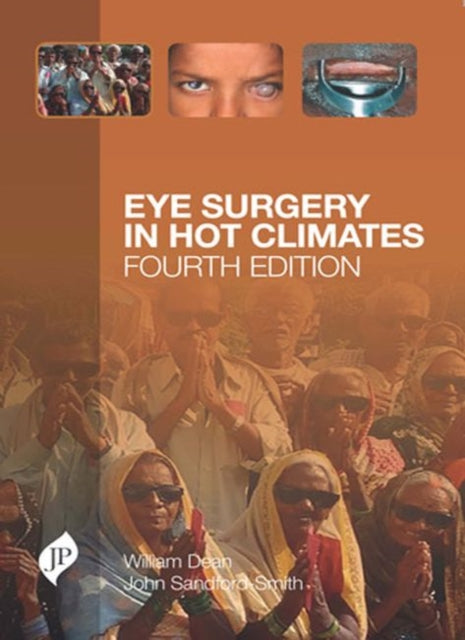 Book cover of: Eye Surgery in Hot Climates. By: William H. Dean