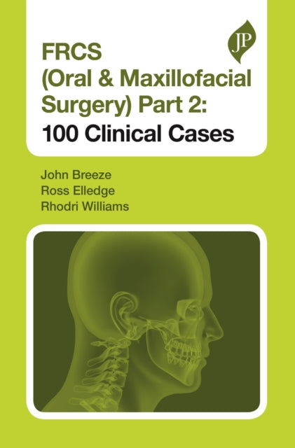 Book cover of: FRCS (Oral & Maxillofacial Surgery) Part 2: 100 Clinical Cases. By: John Breeze